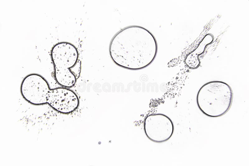 Infection urinaire sous le microscope images stock Infection urinaire sous le microscope images stock