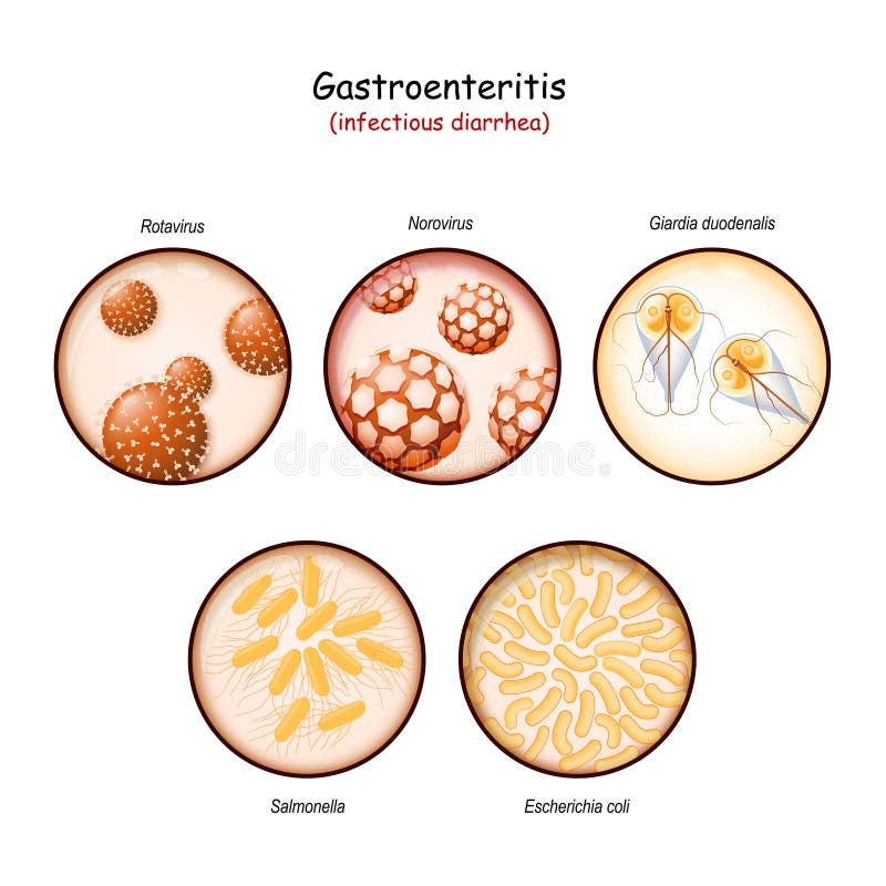 Giardia bacteria or virus, Gyomor-bélhurut - Giardiasis bacteria or virus