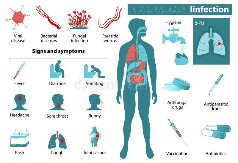 Infekci infographics royalty ilustracja Infekci infographics royalty ilustracja