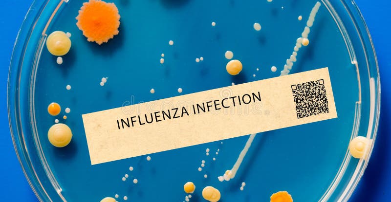 Influenza - Viral infection that causes respiratory illness with symptoms like fever, cough, and sore throat royalty free illustration