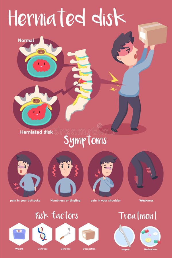 Herniated Disc and Symptoms (Infographic)