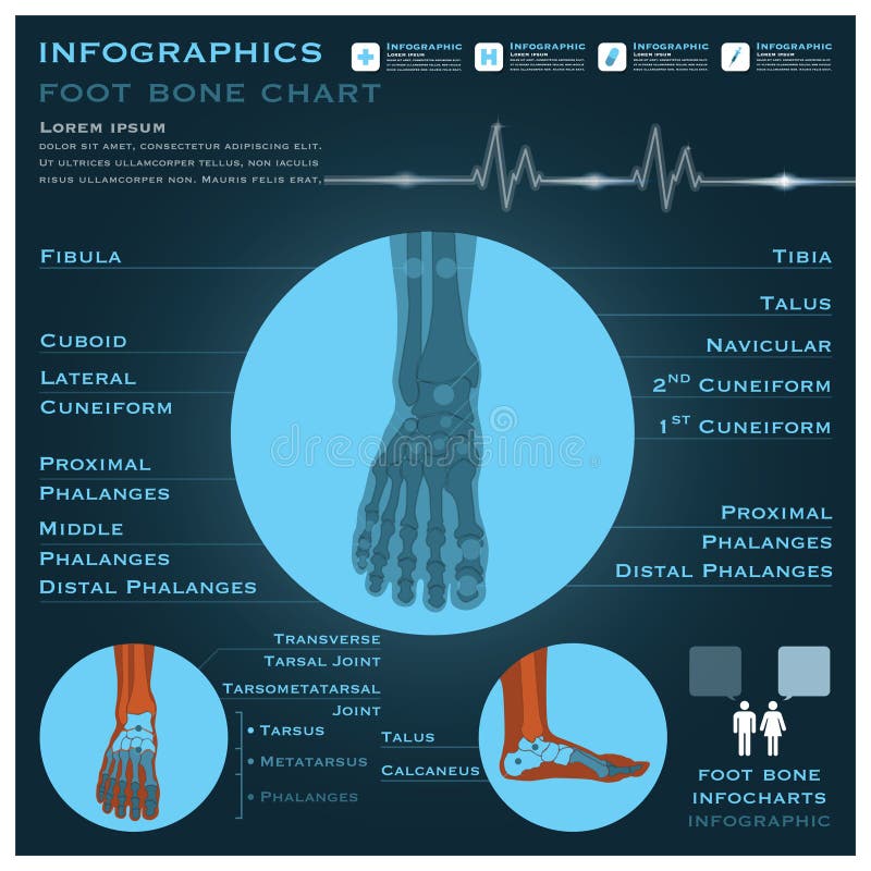 Infographic Infocharts för fotben hälsa och läkarundersökning royaltyfri illustrationer Infographic Infocharts för fotben hälsa och läkarundersökning royaltyfri illustrationer