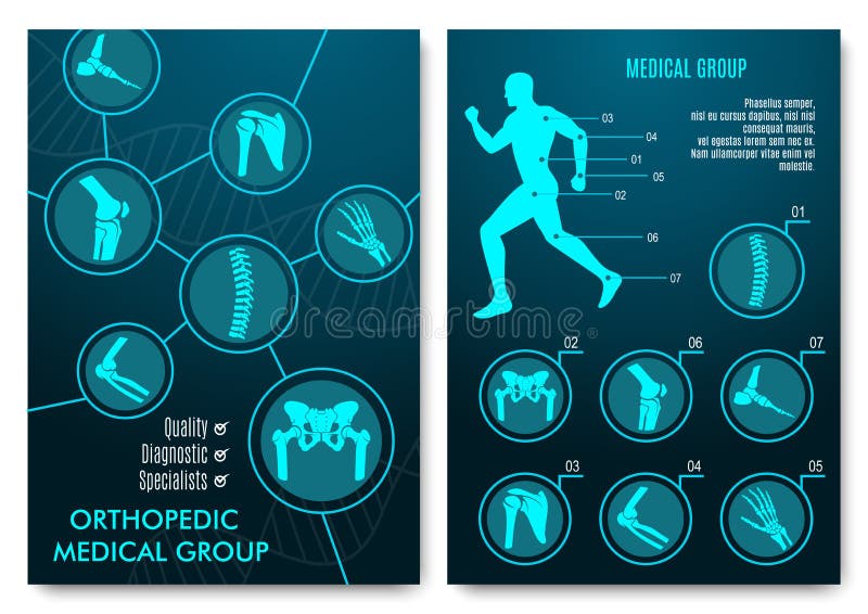 Infográfico médico com gráficos de anatomia ortopédica ilustração royalty free