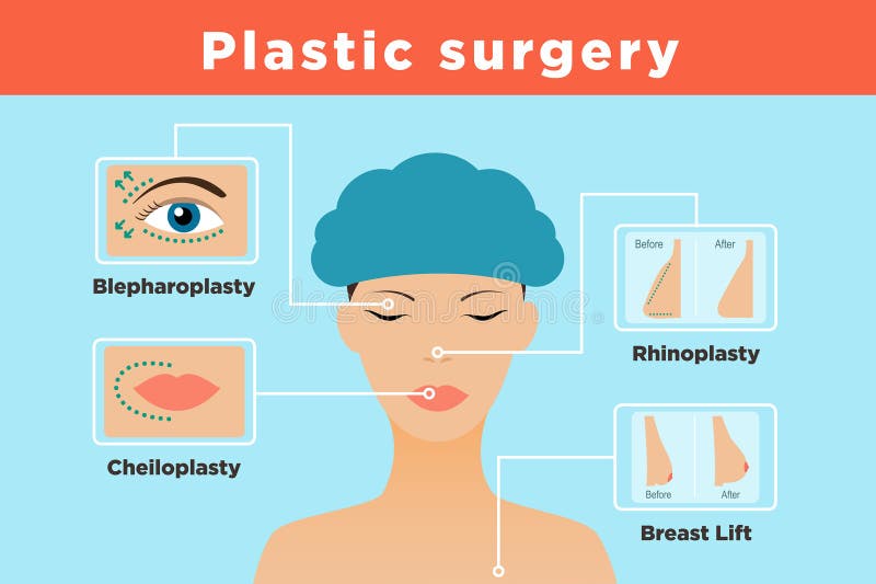 Ruston Sanchez, MD Plastic Surgery