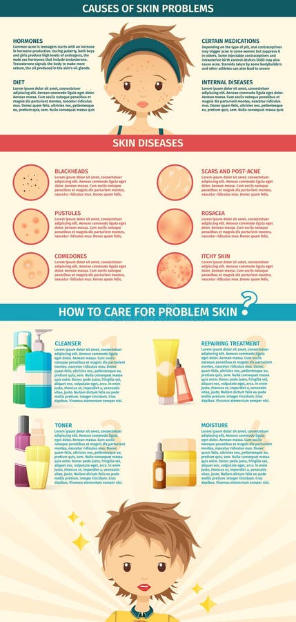 Infographics of the skin problem. Transformation royalty free illustration Infographics of the skin problem. Transformation royalty free illustration