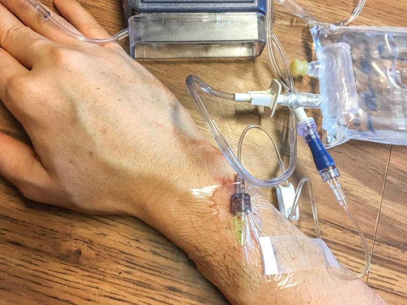 Infusion or IV injection. stock image. Image of cure 100929671