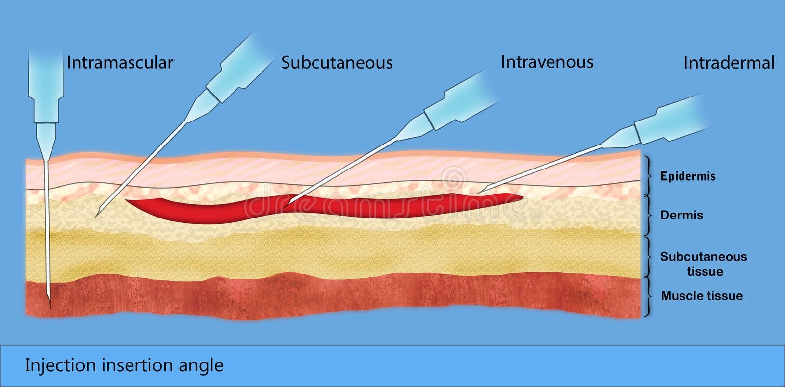Subcutaneous Injections of Heparin on the Belly. Barechested Person