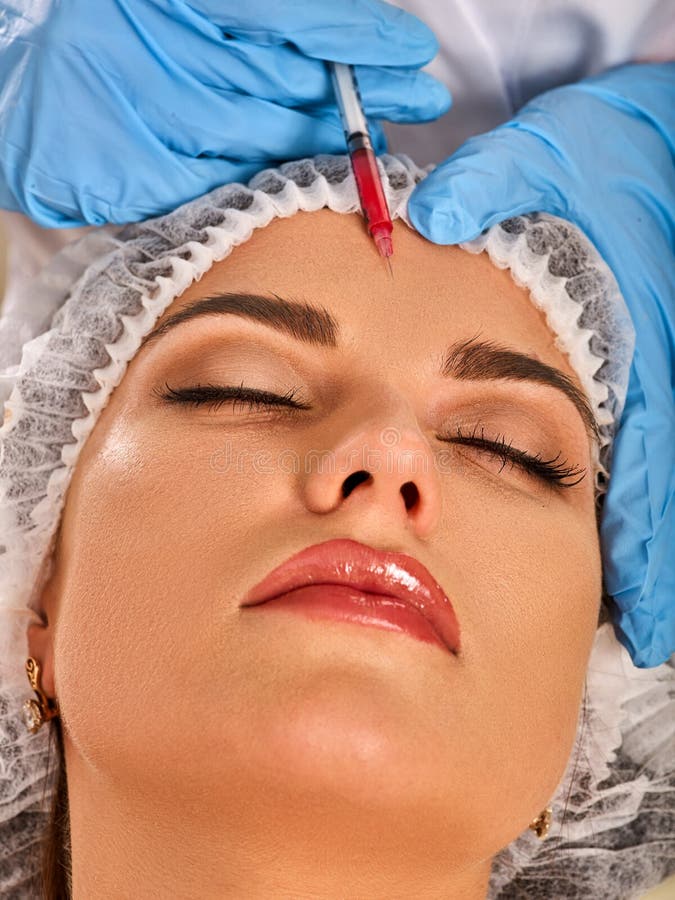 Injeção do enchimento para a cara da testa Cirurgia facial estética plástica imagens de stock royalty free Injeção do enchimento para a cara da testa Cirurgia facial estética plástica imagens de stock royalty free
