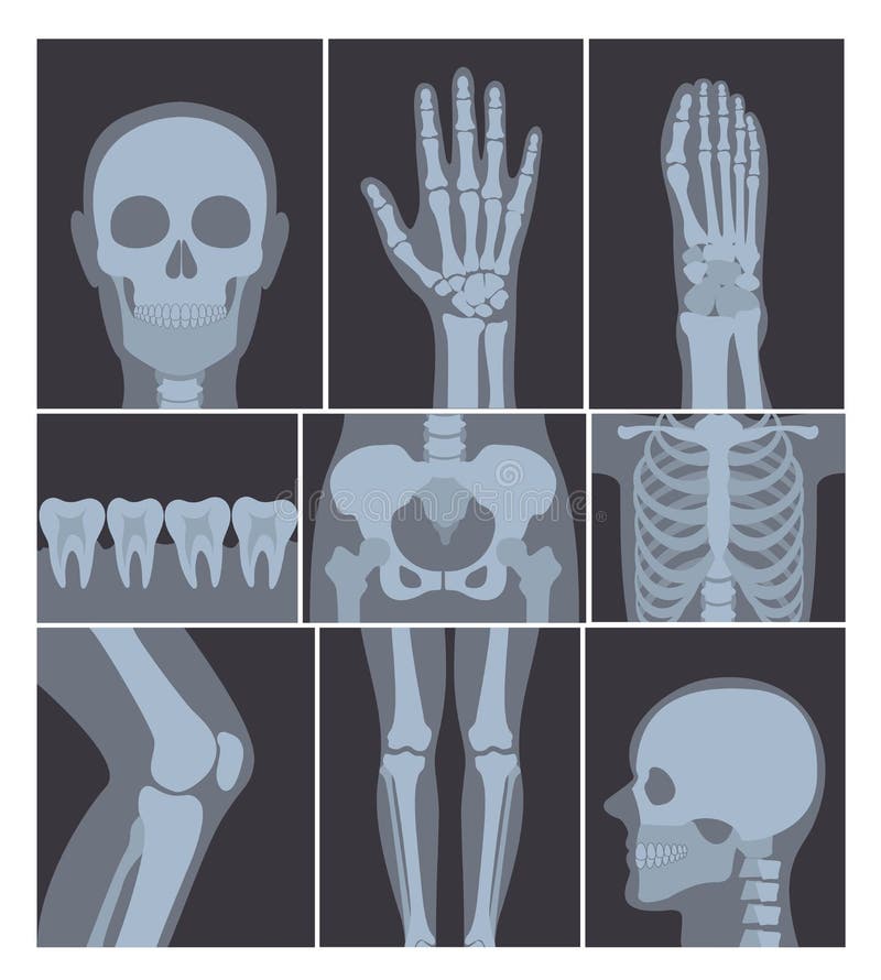 Insieme dell'illustrazione di vettore dei colpi dei raggi x Mano, testa, ginocchio ed altre parti del corpo umano X sui colpi del illustrazione vettoriale Insieme dell'illustrazione di vettore dei colpi dei raggi x Mano, testa, ginocchio ed altre parti del corpo umano X sui colpi del illustrazione vettoriale