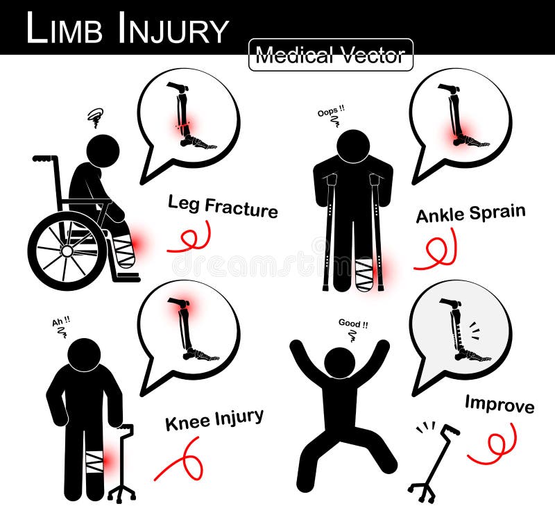 Insieme della lesione dell'arto (uomo del bastone con sedia a rotelle, la gruccia ascellare, la canna del treppiede) (tibia di fr illustrazione vettoriale Insieme della lesione dell'arto (uomo del bastone con sedia a rotelle, la gruccia ascellare, la canna del treppiede) (tibia di fr illustrazione vettoriale