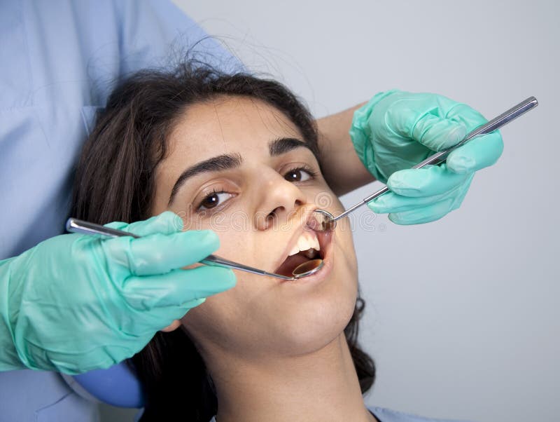 Écarteur Buccal McIvor Pour Chirurgie Dentaire - Instrument D'anesthésie Et D'accès