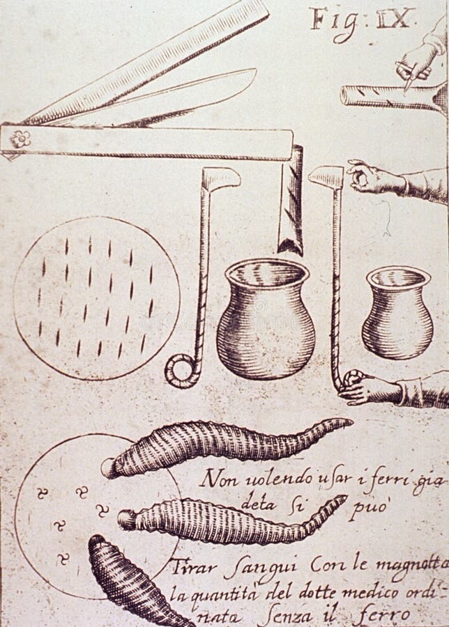 Instruments Used For Bloodletting Picture. Image 222365060