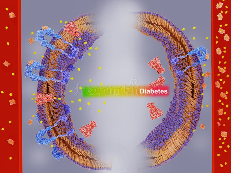 Insulin resistance, insulin receptors cannot respond properly to insulin binding