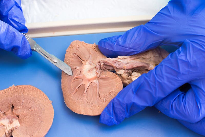 Medical student studying the internal structure of a sheep kidney using a cross section to examine the tissue during anatomy class, close up of the gloved hands