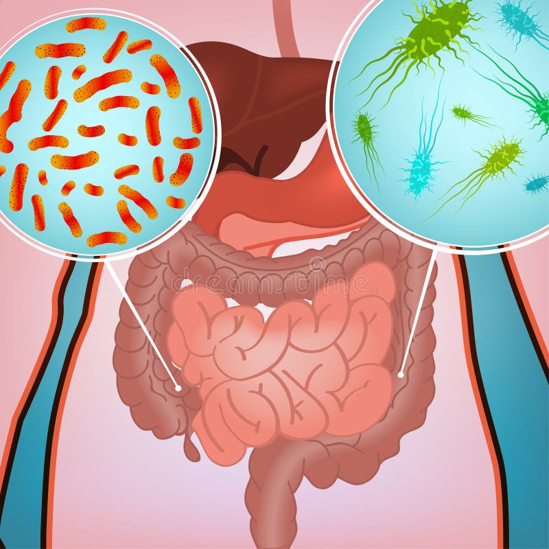 Intestinaal besmettingsbeeld vector illustratie Intestinaal besmettingsbeeld vector illustratie