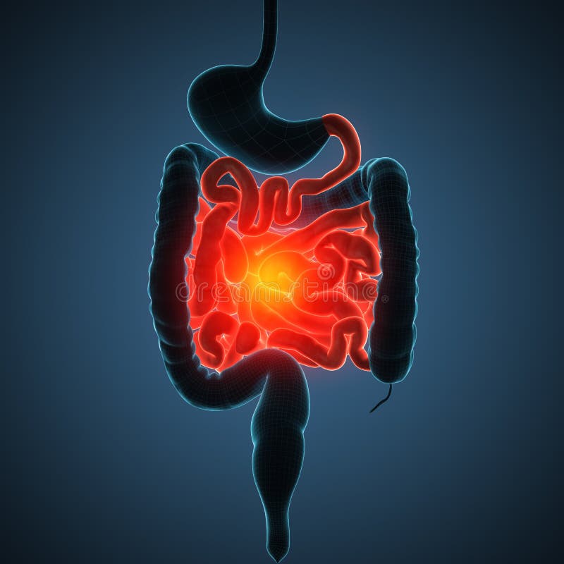 Intestines disease illustration vector illustration