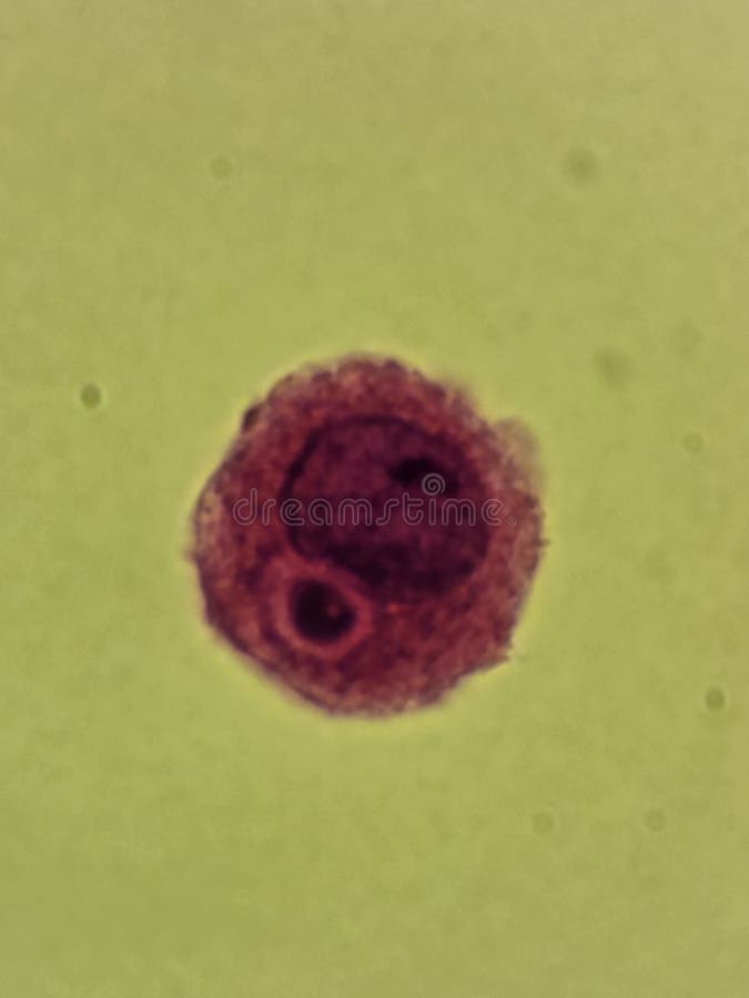 Crytpococcus neoformans encapsulated organism inside macrophage stock photography