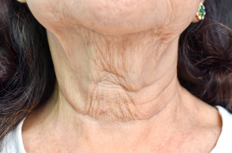 Invecchiamento della pelle o pieghe cutanee o rughe al collo di una donna asiatica e cinese anziana