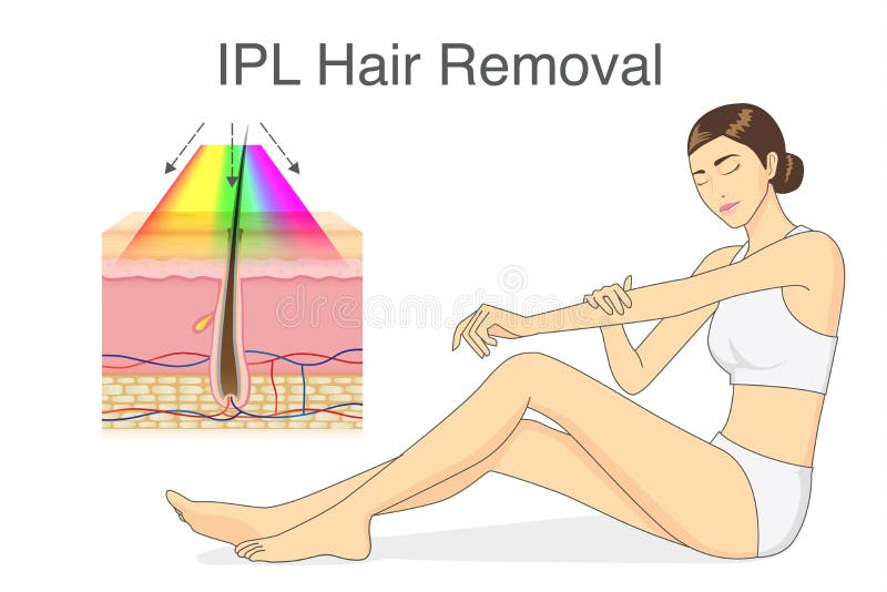 IPL light for hair removal on skin layer and beauty woman touching her skin. royalty free illustration IPL light for hair removal on skin layer and beauty woman touching her skin. royalty free illustration