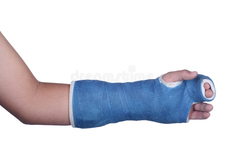 Isolated blue cast stock photo. Image of injury, copyspace - 11292308