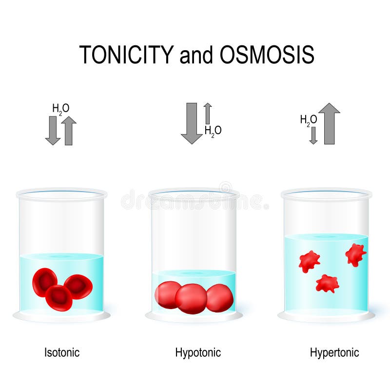 Isotonic, Hypotonic and Hypertonic solutions effects on animal cells. Tonicity and osmosis. This diagram shows the effects of hypertonic, hypotonic and istonic solutions to red blood cells. Vector illustration for biological, medical, science and educational use. Isotonic, Hypotonic and Hypertonic solutions effects on animal cells. Tonicity and osmosis. This diagram shows the effects of hypertonic, hypotonic and istonic solutions to red blood cells. Vector illustration for biological, medical, science and educational use