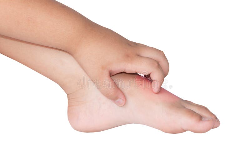 Itching foot stock photo. Image of allergy, itchy, fingers 70736514