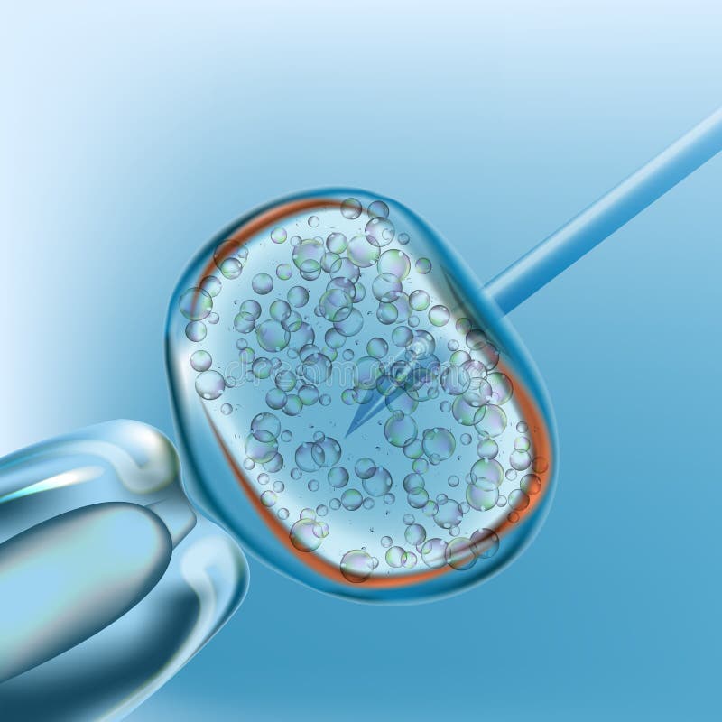 IVF Inseminación artificial Diseño realista del vector libre illustration IVF Inseminación artificial Diseño realista del vector libre illustration