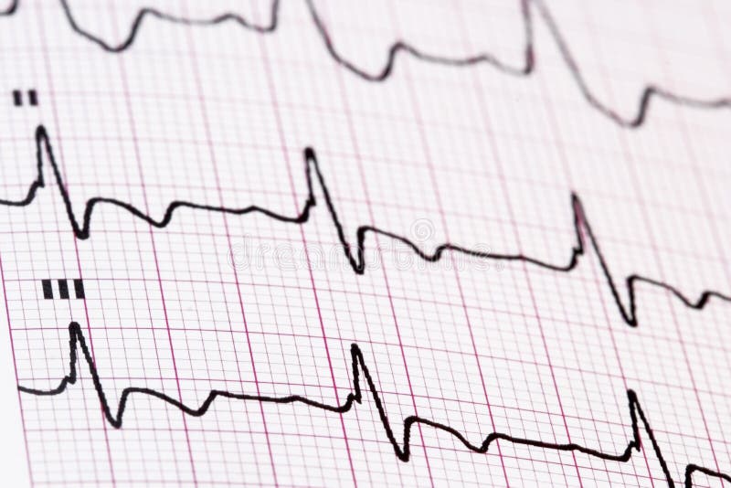 Ekg/ ecg as a medical background. Ekg/ ecg as a medical background