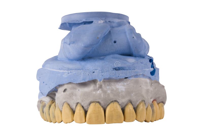 Jaw tooth isolated stock photo. Image of implants, health 127682062