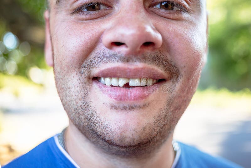 Jeune homme avec une dent ébréchée image stock Jeune homme avec une dent ébréchée image stock