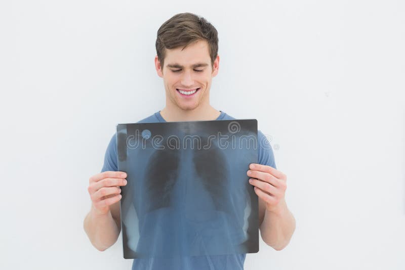 Jeune homme de sourire tenant le rayon X de poumon photo stock Jeune homme de sourire tenant le rayon X de poumon photo stock