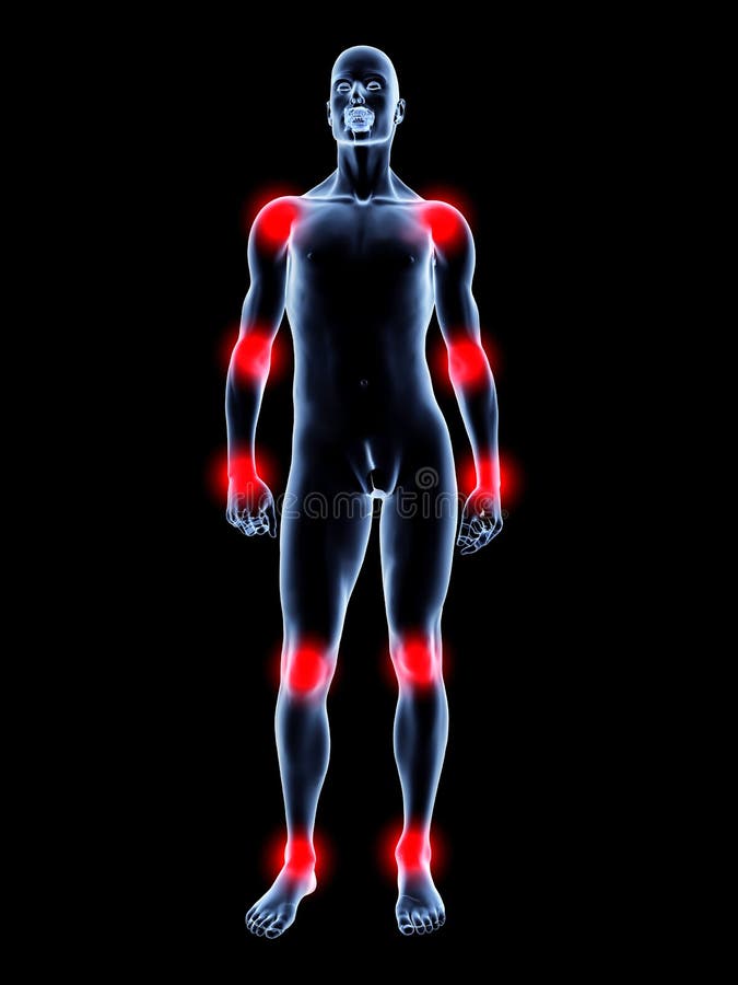 Joint ache - Anatomy vector illustration Joint ache - Anatomy vector illustration