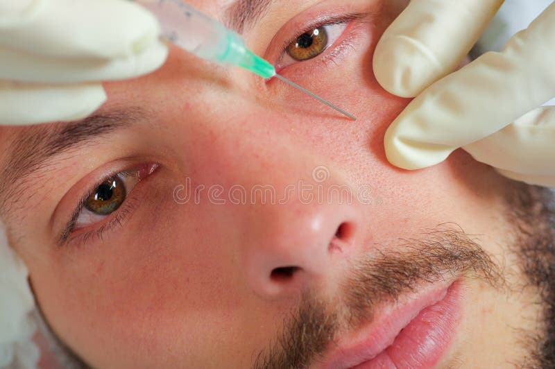 Jonge de close-up bemant gezicht die gezichts kosmetische behandelingsinjecties, artsenhand met de spuit van de handschoenholding royalty-vrije stock afbeeldingen Jonge de close-up bemant gezicht die gezichts kosmetische behandelingsinjecties, artsenhand met de spuit van de handschoenholding royalty-vrije stock afbeeldingen