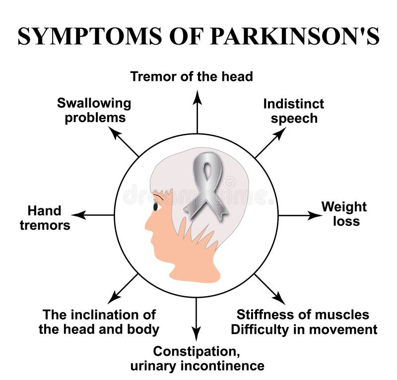 Jour de Parkinson du monde Symptômes de la maladie du ` s de Parkinson Tête d'un homme avec un ruban argenté Illustration de vect illustration stock Jour de Parkinson du monde Symptômes de la maladie du ` s de Parkinson Tête d'un homme avec un ruban argenté Illustration de vect illustration stock
