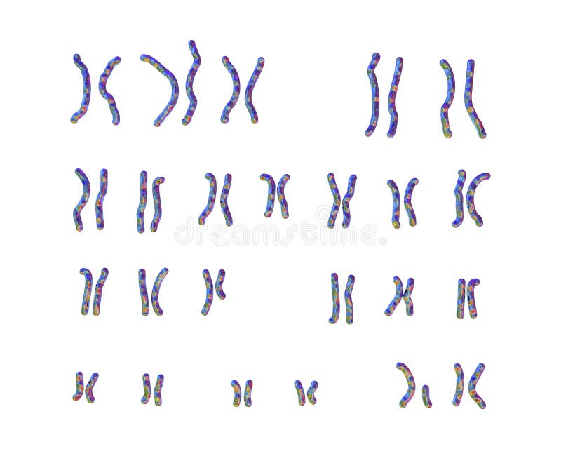 dwarfism karyotype