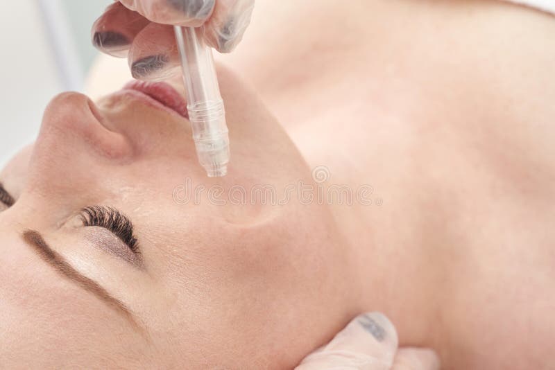 Kaukasische erwachsene Frauen, die eine professionelle Gesichtspflege erhalten lizenzfreies stockfoto