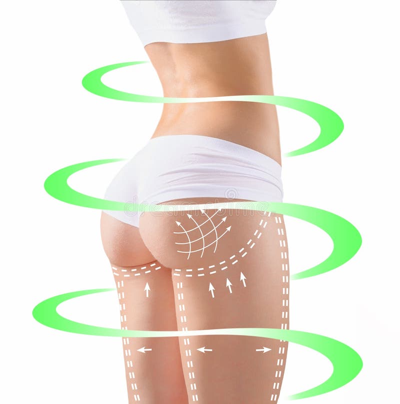 Kennzeichen auf den Frauen ` s Hinterteilen, der Taille und den Beinen vor plastischer Chirurgie lizenzfreies stockbild Kennzeichen auf den Frauen ` s Hinterteilen, der Taille und den Beinen vor plastischer Chirurgie lizenzfreies stockbild