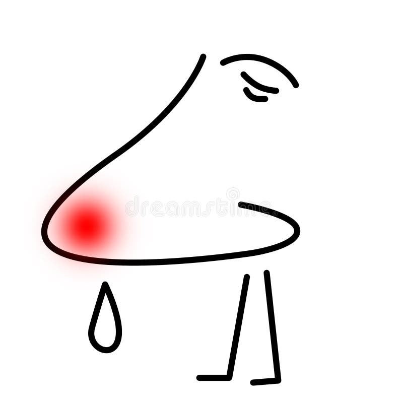 Kerl mit der Grippe oder mit einer Allergie lizenzfreie abbildung Kerl mit der Grippe oder mit einer Allergie lizenzfreie abbildung
