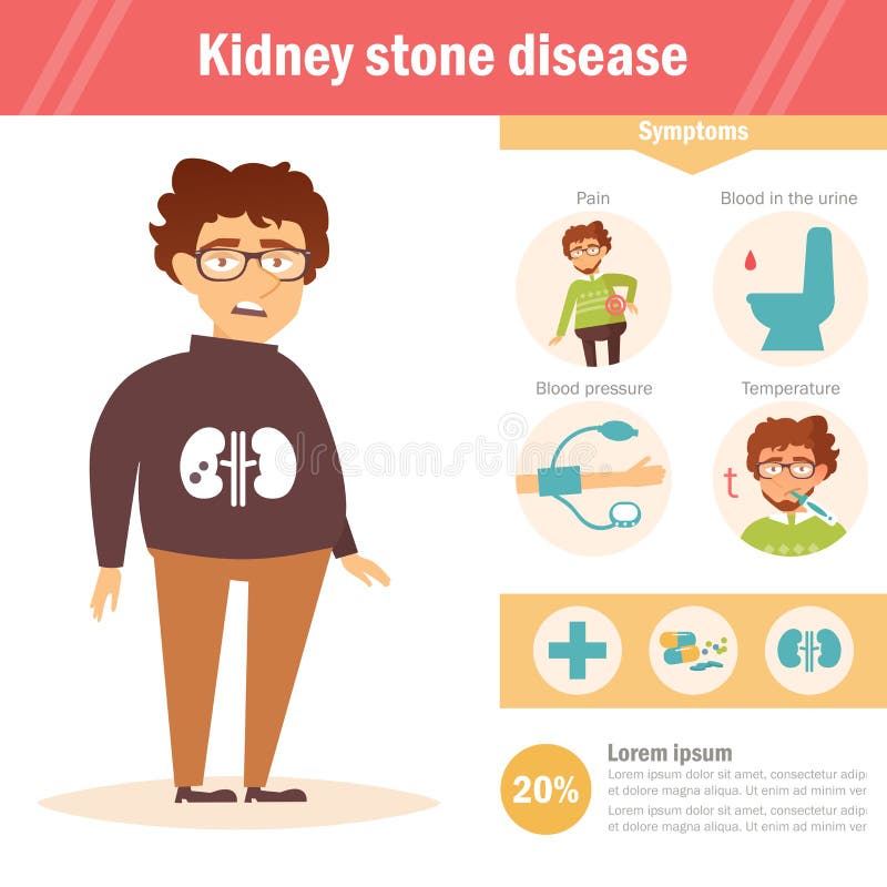 Kidney Stone Disease. Infographics. Vector. Cartoon. Stock Vector