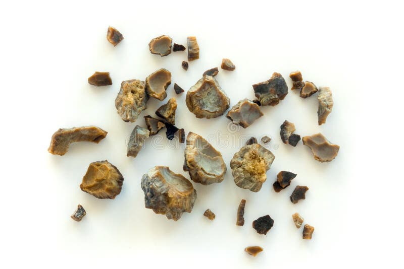 Kidney stones stock photos