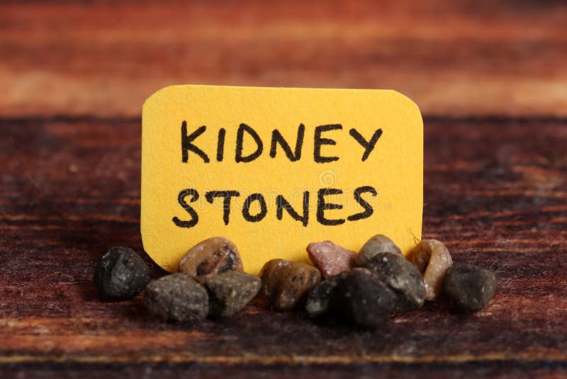 Concept shot of kidney stones.