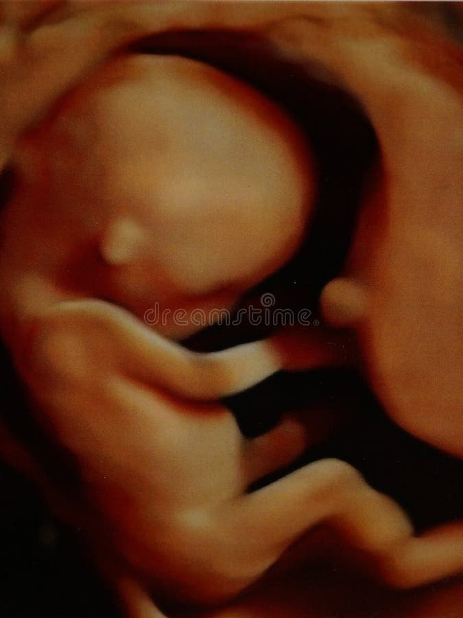 Klein foetus royalty-vrije stock afbeeldingen Klein foetus royalty-vrije stock afbeeldingen