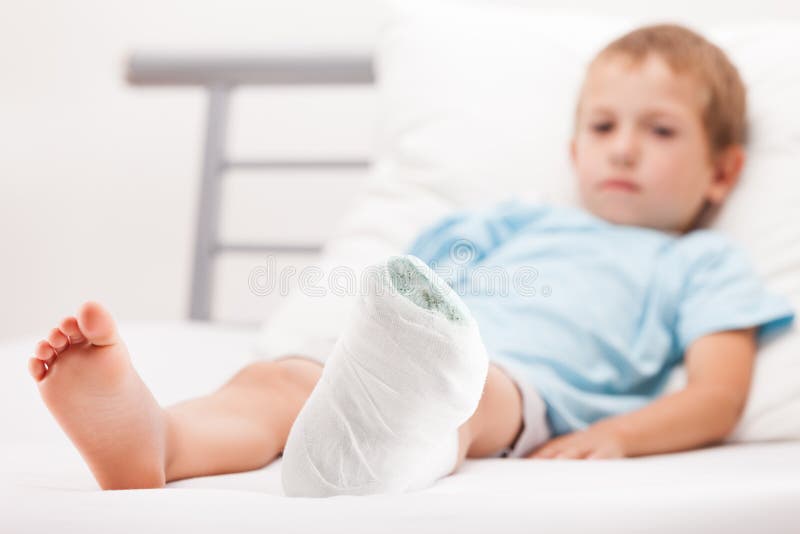 Kleines Kinderjunge mit Gipsverband auf Beinfersenbruch oder -br