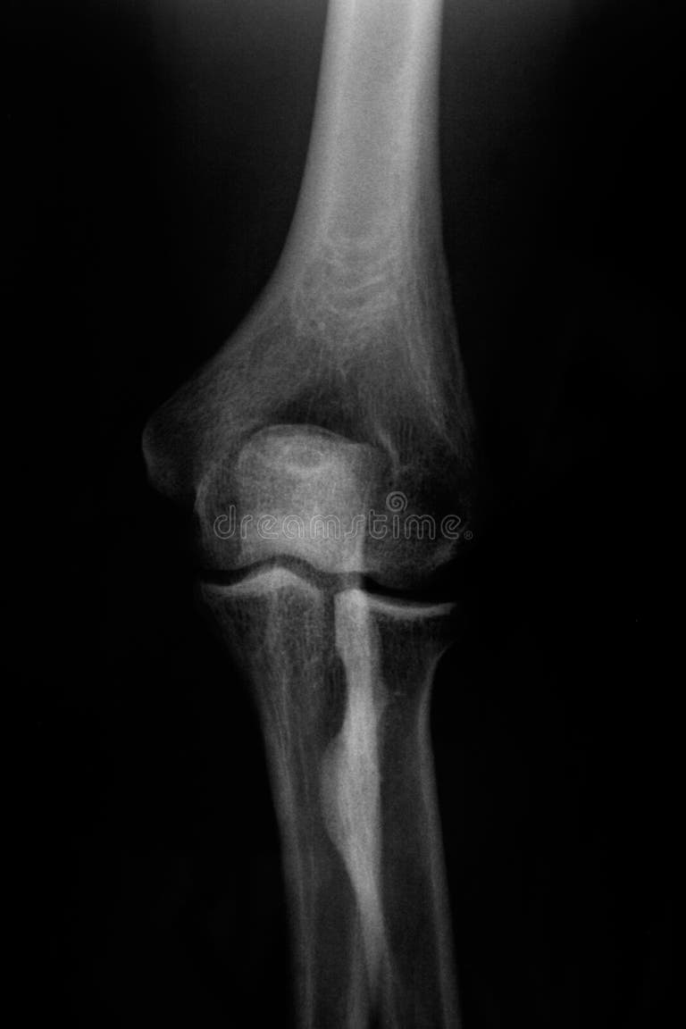 233 Knee Bone Structure Stock Photos Free & RoyaltyFree Stock Photos