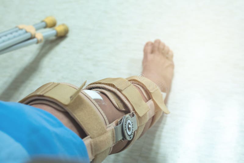 Knee with Knee Brace Support after Surgery with Walking Stick of Patient in  Hospital Stock Photo - Image of male, equipment: 158397764