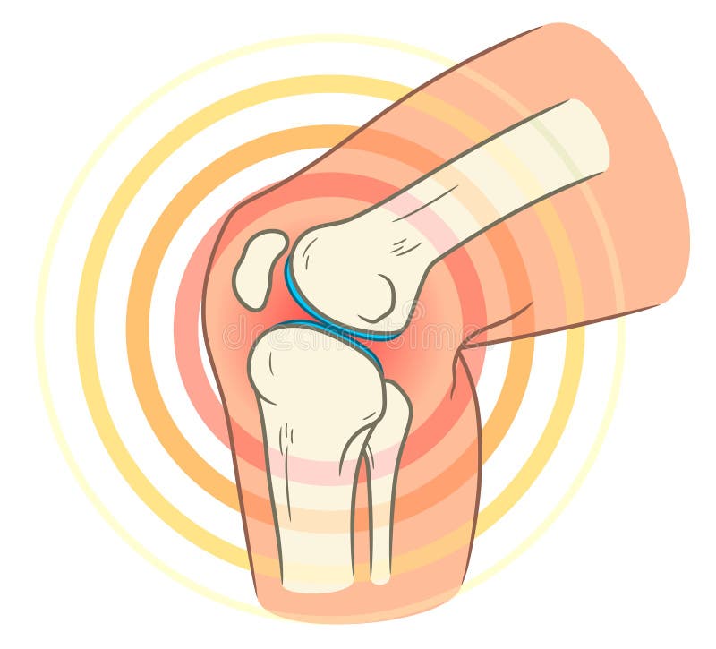 Knee joint pain stock illustration Knee joint pain stock illustration