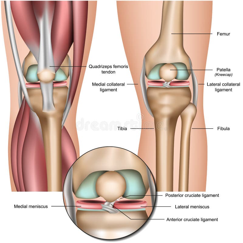 patella femorális fájdalom szindróma