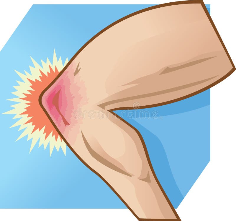 Knee Pain illustration stock illustration