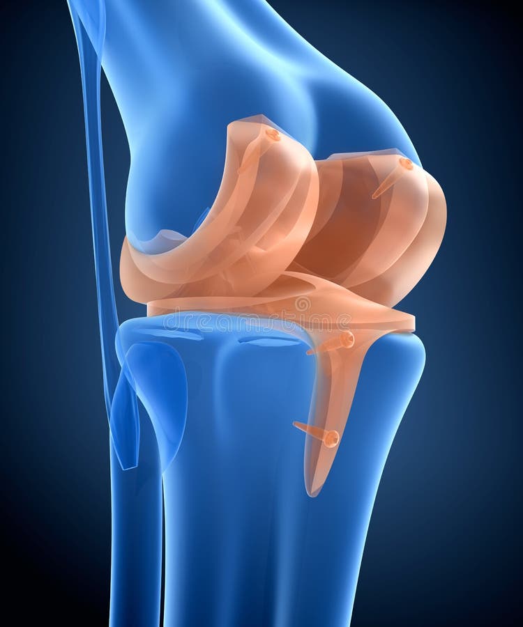 Knee and Titanium Hinge Joint Stock Illustration Illustration of