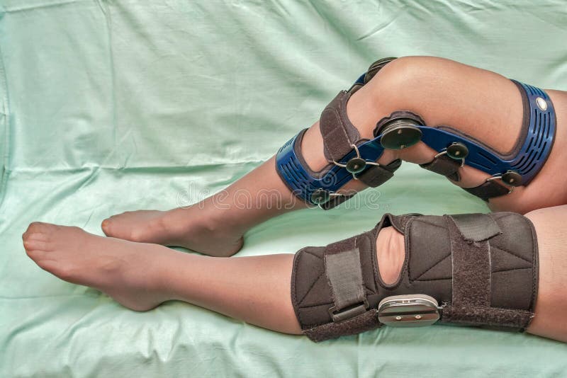 Female's legs in two different types of knee braces used after knees injuries isolated on green medical canvas. Female's legs in two different types of knee braces used after knees injuries isolated on green medical canvas.